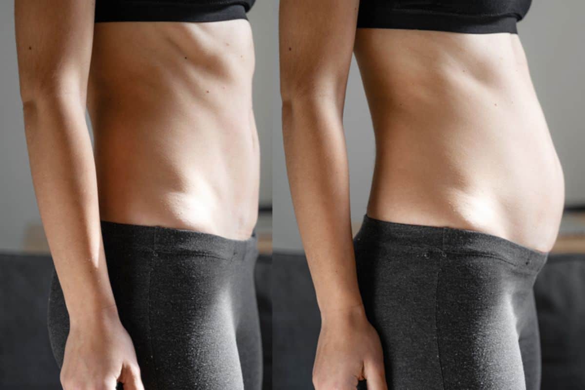 How long does diastasis recti take to improve Acton?