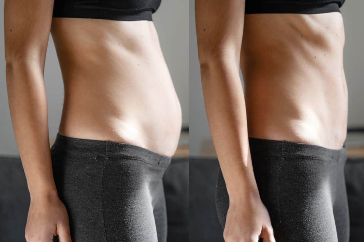 Post-Pregnancy: What Happens to Your Abdominal Muscles After Birth Acton