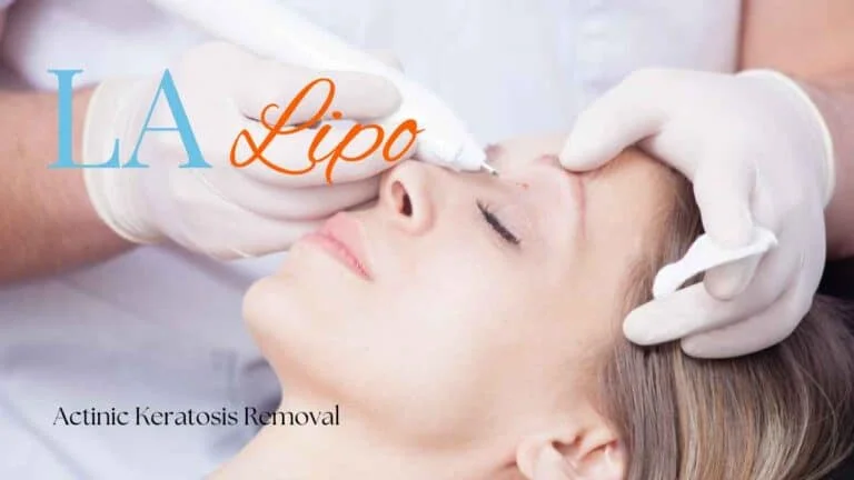 Woman receiving Actinic Keratosis Removal Treatment Acton