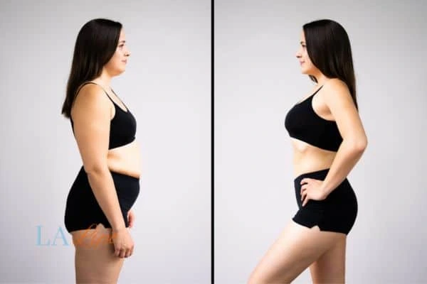 LA-EMS Body Sculpting Acton results before and after of womans results on body toning.