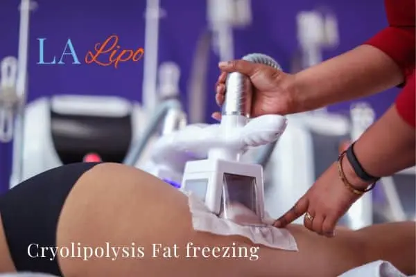 women getting fat freezing Acton