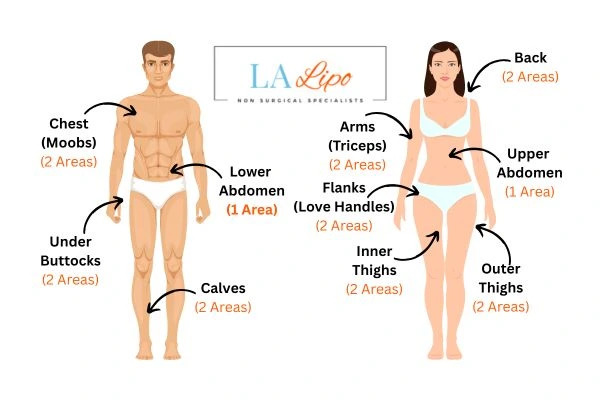 LA LIPO Cryolipolysis Areas Acton