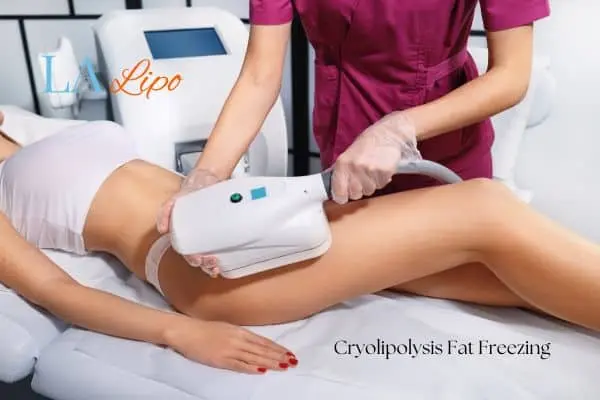 Woman receiving coolsculpting Acton treatment on her thighs