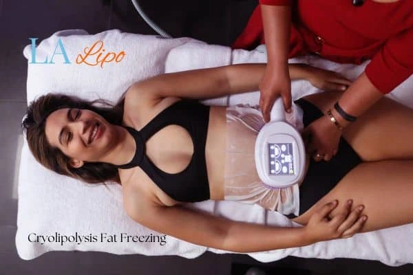 woman getting cryolipolysis Acton