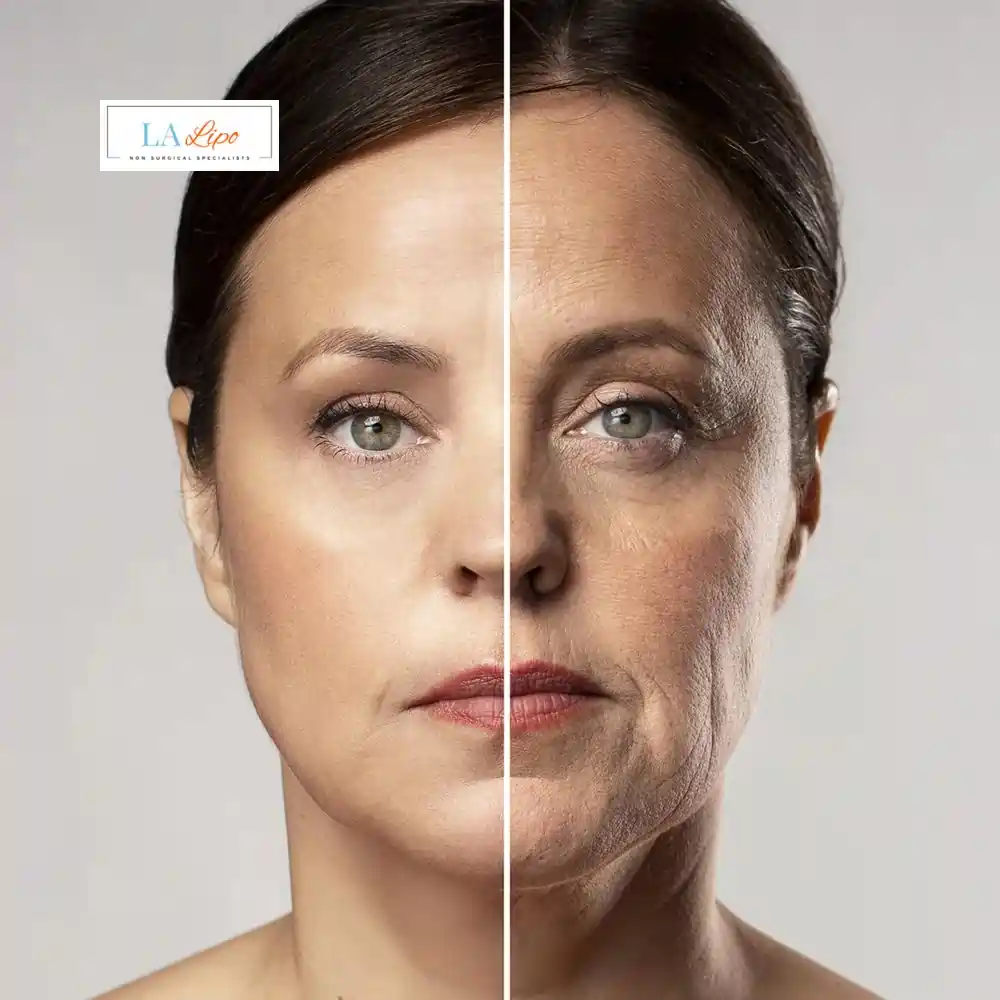 How Can You Tell If Non-Surgical Skin Tightening Is Right for You Acton?