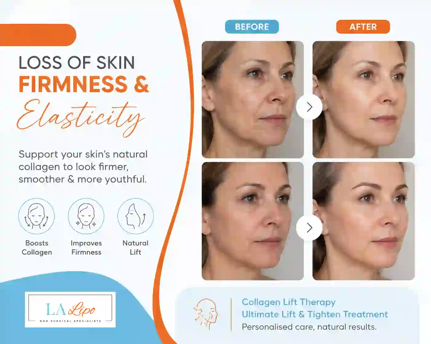 Sign #7: Loss of Skin Firmness and Elasticity Acton
