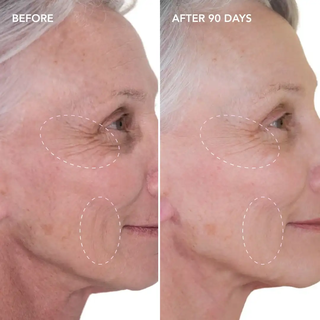 When will you see results Acton